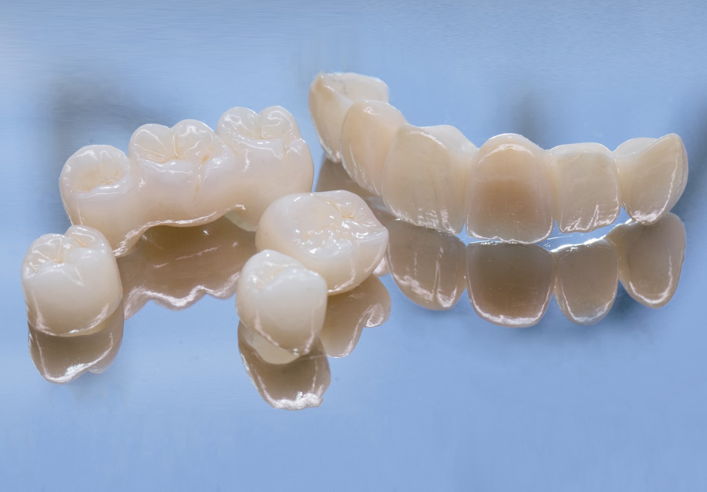 metal-free-dental image